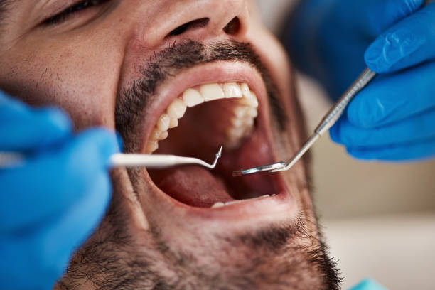 Best Emergency Denture Repair in Fate, TX